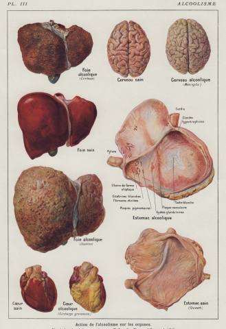 Alcohol Effects on Human Organs